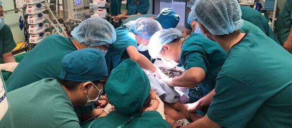 Tiến hành những bước đầu tiên cho cuộc đại phẫu tách dính song sinh lịch sử. - Sputnik Việt Nam