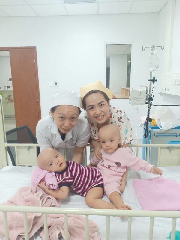 Ngành y tế Việt Nam tiếp tục lập kỳ tích: Sức khỏe Trúc Nhi và Diệu Nhi giờ ra sao? - Sputnik Việt Nam