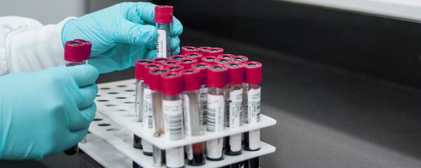 Ống nghiệm có máu. - Sputnik Việt Nam