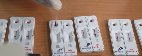 Xét nghiệm coronavirus - Sputnik Việt Nam