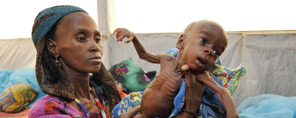 Phụ nữ và trẻ em suy dinh dưỡng ở nam Niger Phụ nữ và trẻ em suy dinh dưỡng ở nam Niger - Sputnik Việt Nam