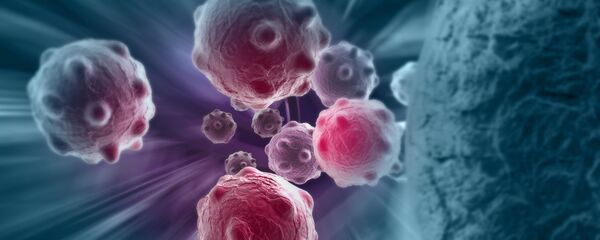 Tế bào ung thư trong cơ thể con người Tế bào ung thư trong cơ thể con người - Sputnik Việt Nam