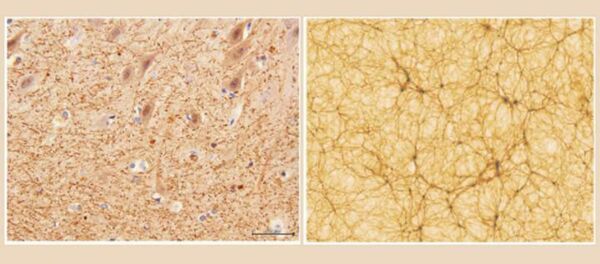 Mặt cắt của tiểu não với độ phóng đại 40x thu được bằng kính hiển vi điện tử (trái) và một phần của mô hình vũ trụ (phải) Mặt cắt của tiểu não với độ phóng đại 40x thu được bằng kính hiển vi điện tử (trái) và một phần của mô hình vũ trụ (phải) - Sputnik Việt Nam