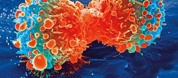 Các tế bào ung thư - Sputnik Việt Nam