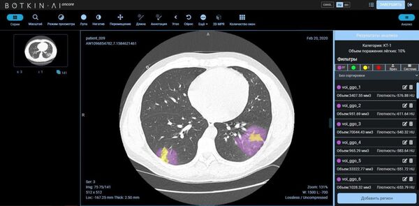 Ứng dụng trí tuệ nhân tạo giúp điều trị bệnh nhân COVID-19 - Sputnik Việt Nam