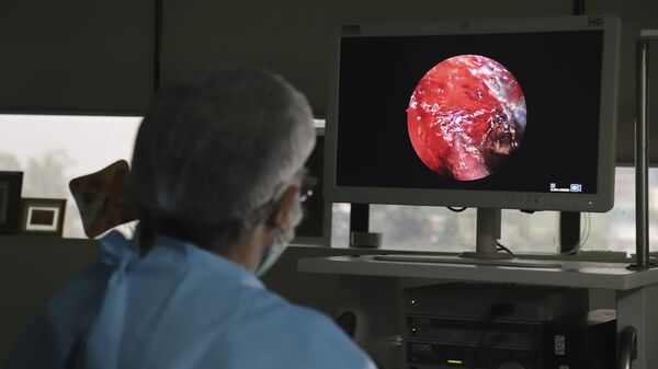 Bác sĩ Ấn Độ thực hiện phẫu thuật nội soi xoang chức năng tiên tiến cho một người đàn ông bị bệnh viêm niêm mạc tại một bệnh viện ở ngoại ô New Delhi, Ấn Độ - Sputnik Việt Nam