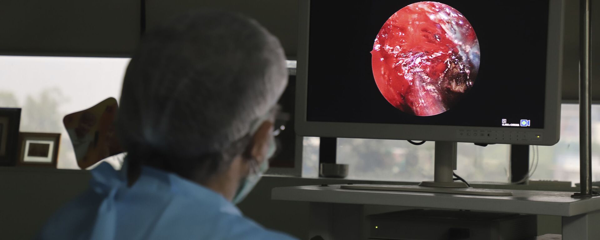 Bác sĩ Ấn Độ thực hiện phẫu thuật nội soi xoang chức năng tiên tiến cho một người đàn ông bị bệnh viêm niêm mạc tại một bệnh viện ở ngoại ô New Delhi, Ấn Độ - Sputnik Việt Nam, 1920, 29.05.2021