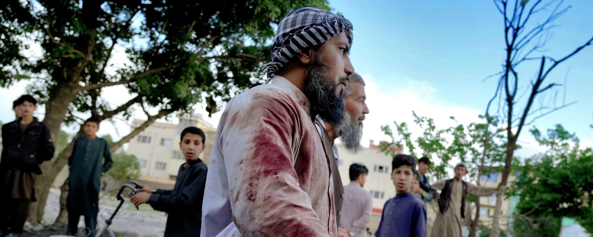 Tín đồ Afghanistan đầm đìa máu gần nhà thờ Hồi giáo ở Kabul nơi vừa xảy ra vụ nổ bom - Sputnik Việt Nam, 1920, 14.05.2025