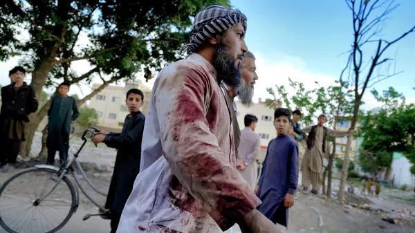 Tín đồ Afghanistan đầm đìa máu gần nhà thờ Hồi giáo ở Kabul nơi vừa xảy ra vụ nổ bom - Sputnik Việt Nam