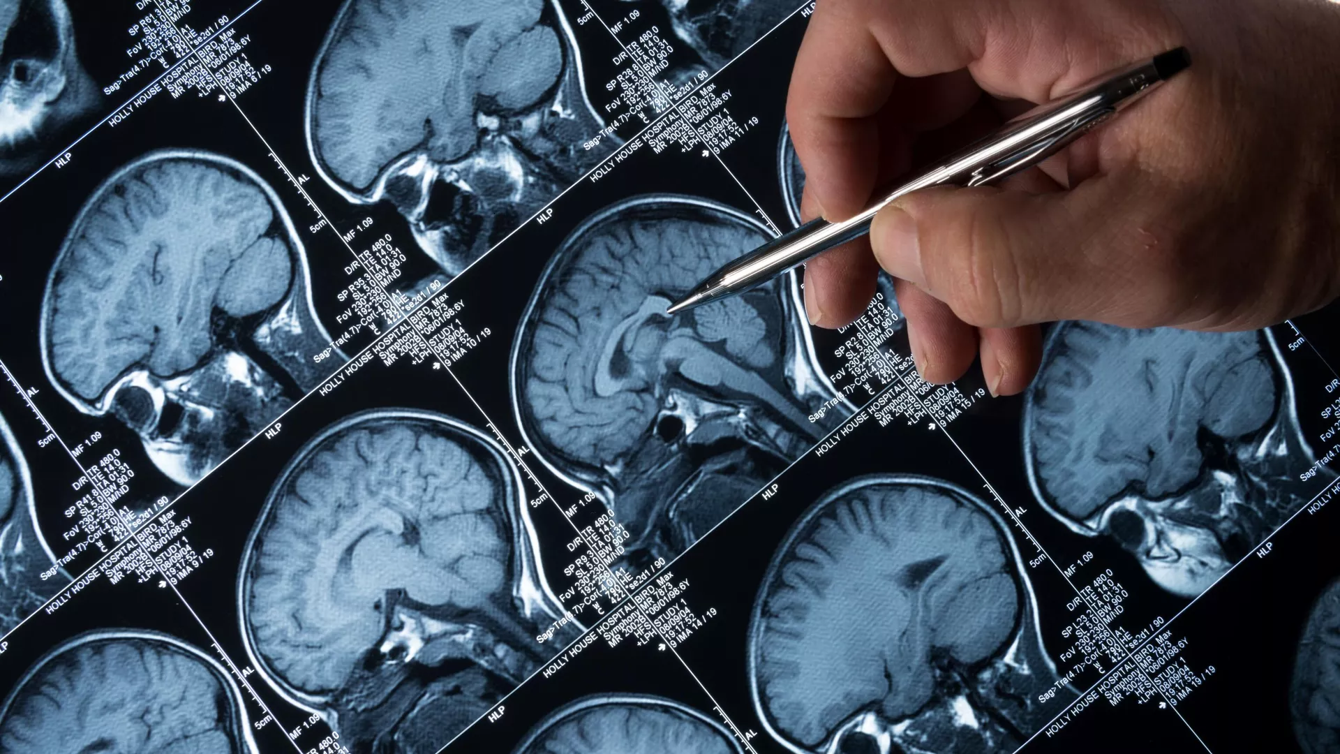 Chụp MRI sọ não Chụp MRI sọ não - Sputnik Việt Nam, 1920, 24.10.2023