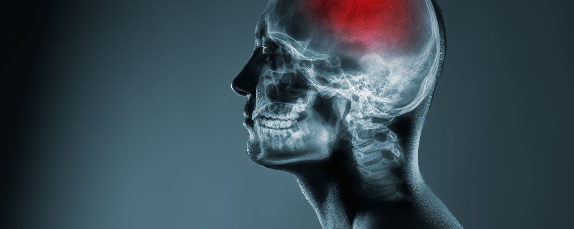 Рентгеновский снимок головы - Sputnik Việt Nam, 1920, 16.12.2024