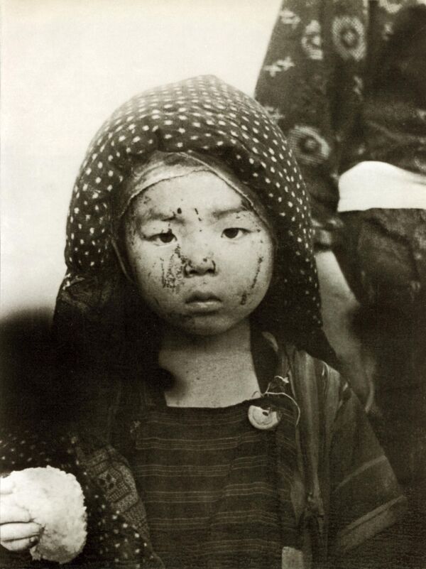 Nạn nhân vụ ném bom nguyên tử tại Nagasaki năm 1945 - Sputnik Việt Nam