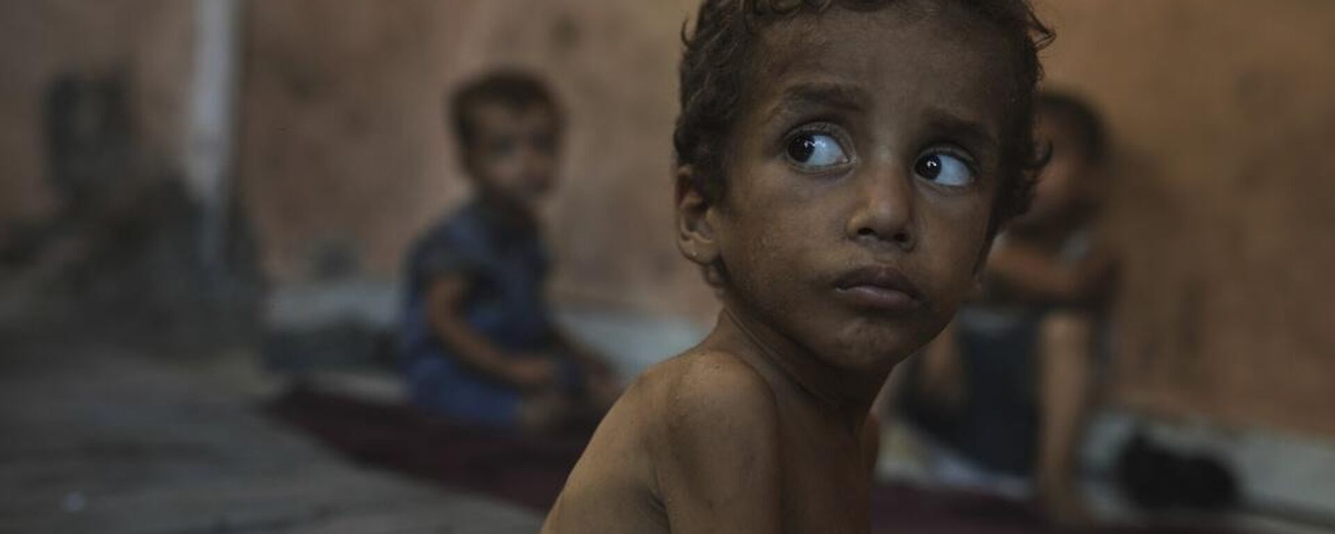 Một đứa trẻ bị suy dinh dưỡng tại trại tị nạn Shati ở Gaza - Sputnik Việt Nam, 1920, 27.08.2025