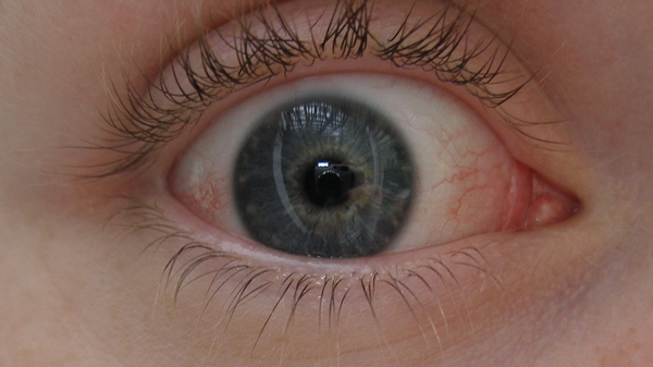 Mắt - Sputnik Việt Nam