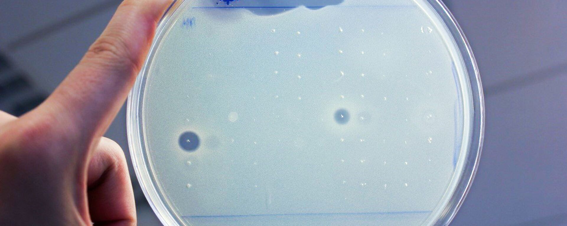 Kháng sinh - Sputnik Việt Nam, 1920, 20.10.2025