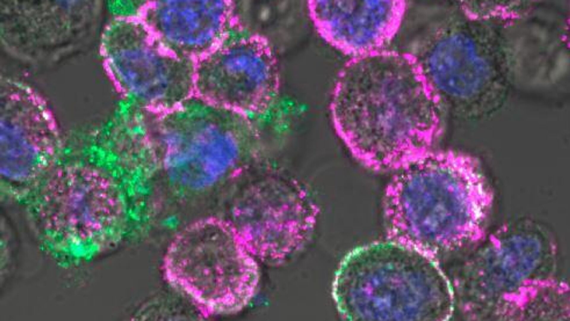 Virus gây ung thư trong tế bào ung thư Virus gây ung thư trong tế bào ung thư - Sputnik Việt Nam, 1920, 03.12.2025