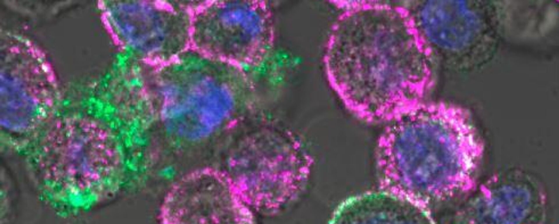 Virus gây ung thư trong tế bào ung thư - Sputnik Việt Nam, 1920, 03.12.2025