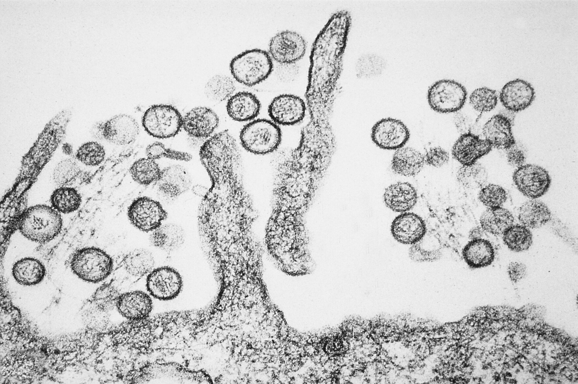 Virus Hanta dưới kính hiển vi - Sputnik Việt Nam, 1920, 08.05.2026