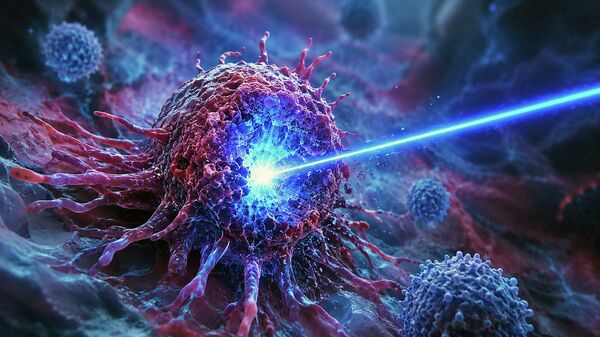 Laser tiêu diệt tế bào ung thư - Sputnik Việt Nam