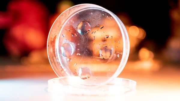 Hydrogel chữa lành vết thương dựa trên сhất làm đặc thực phẩm từ tảo, được phát triển tại NUST MISiS - Sputnik Việt Nam