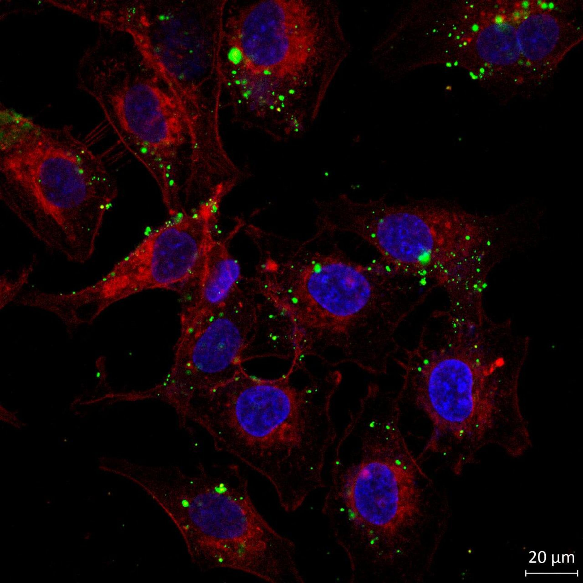 Phân tử mRNA trong tế bào người Phân tử mRNA trong tế bào người - Sputnik Việt Nam, 1920, 13.10.2026