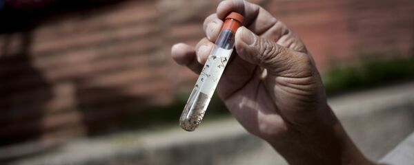 Virus Zika Virus Zika - Sputnik Việt Nam