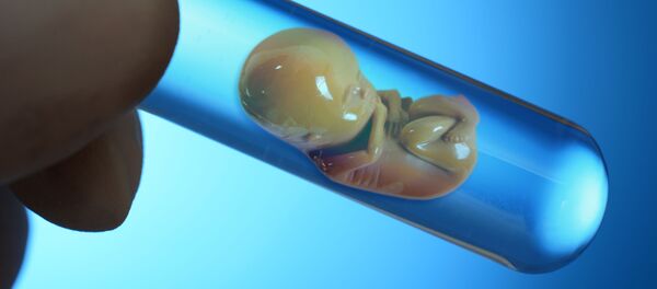 phôi thai phôi thai - Sputnik Việt Nam