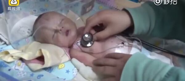 con chó cứu em bé bị chon sống - Sputnik Việt Nam