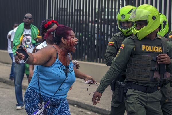 Colombia. Người phụ nữ bị thương trong cuộc biểu tình dân sự đang phân xử với cảnh sát. - Sputnik Việt Nam