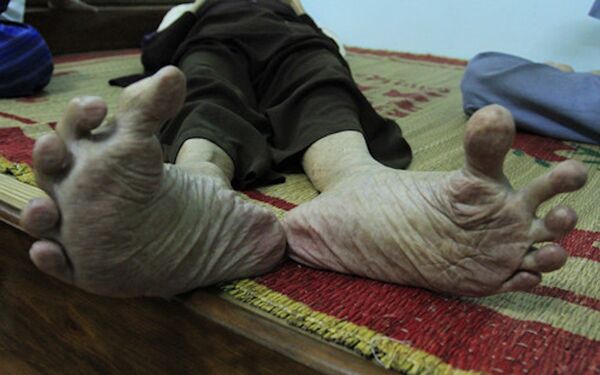 Cách đây mấy năm, các con cụ đi nước ngoài mua được hai đôi dép ngoại cỡ biếu bố, song để đi vừa cũng phải khoét một lỗ cho ngón cái thò ra.  - Sputnik Việt Nam