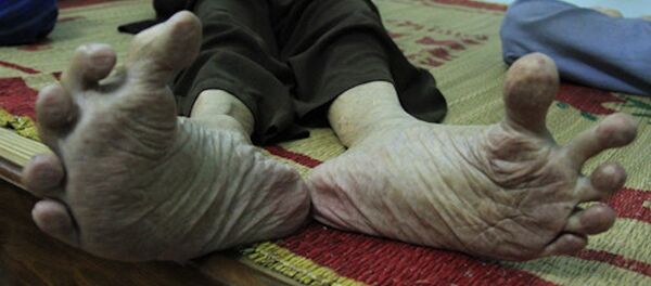 Cách đây mấy năm, các con cụ đi nước ngoài mua được hai đôi dép ngoại cỡ biếu bố, song để đi vừa cũng phải khoét một lỗ cho ngón cái thò ra. - Sputnik Việt Nam