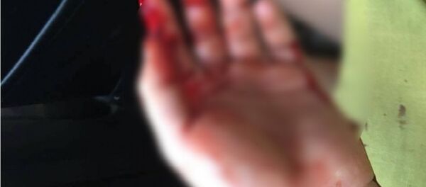 Mặc dù đã ly hôn nhưng chị P. vẫn bị chồng cũ tiếp tục bạo hành - Sputnik Việt Nam