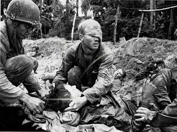 Lực lượng quân y Mỹ trên chiến trường Việt Nam Lực lượng quân y Mỹ trên chiến trường Việt Nam - Sputnik Việt Nam