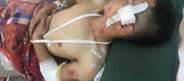 Anh Toàn (anh ruột anh Tâm) đang được điều trị tại Bệnh viện Đa khoa tỉnh Hải Dương. - Sputnik Việt Nam