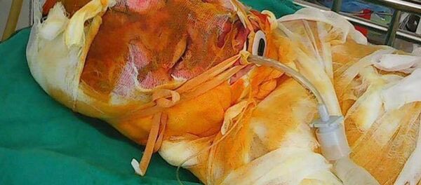 Cháu Đức hiện rất mong nhận được sự giúp đỡ của mọi người - Sputnik Việt Nam