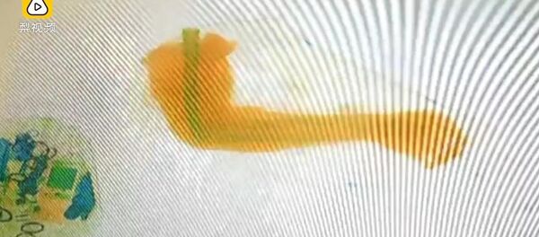 Cánh tay được phát hiện - Sputnik Việt Nam