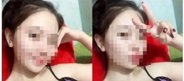 Hình ảnh thai phụ tử vong sau nâng ngực. - Sputnik Việt Nam