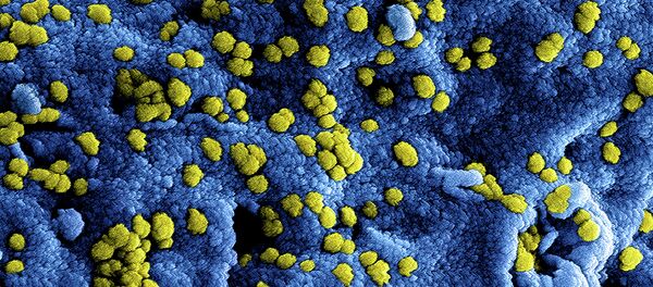 MERS Coronavirus Particles MERS Coronavirus Particles - Sputnik Việt Nam