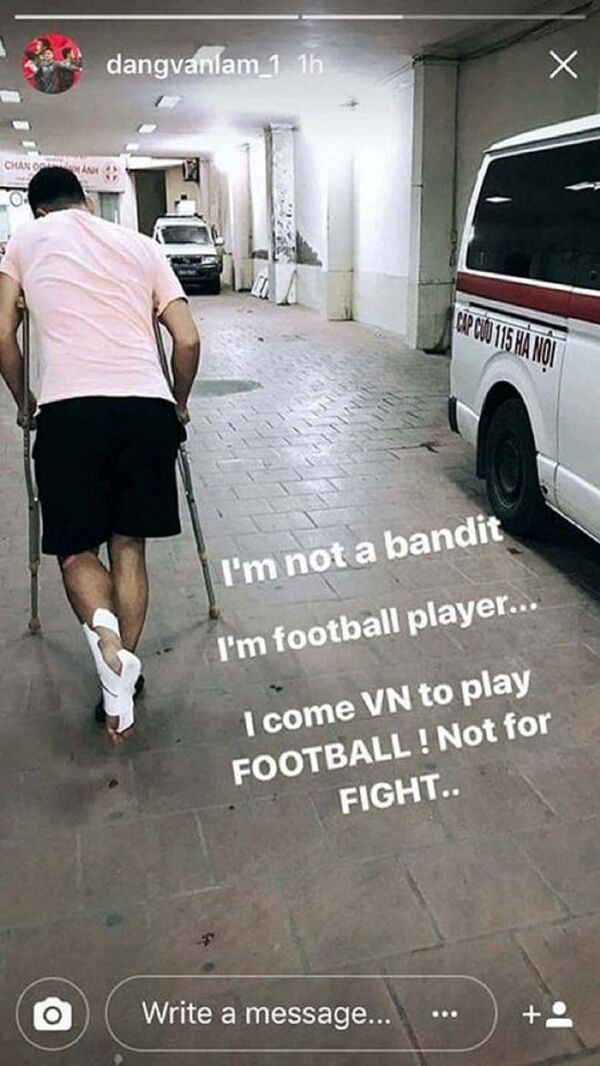 Đặng Văn Lâm đăng tải hình ảnh cùng nội dung sau khi bị đàn anh dạy dỗ - Sputnik Việt Nam