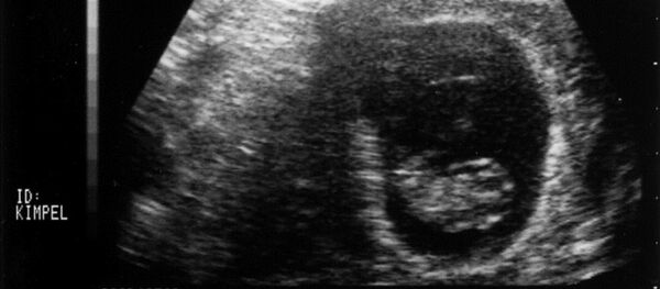 Phôi thai Phôi thai - Sputnik Việt Nam