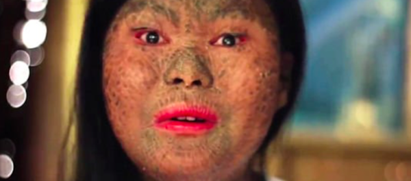 Cô gái người rắn với vảy da trên khuôn mặt làm dân mạng Internet chấn động (Video) - Sputnik Việt Nam