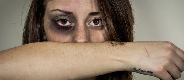 Девушка с синяком под глазом - Sputnik Việt Nam