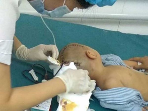 Bé 3 tuổi bị chấn thương sọ não ở trường mầm non - Sputnik Việt Nam