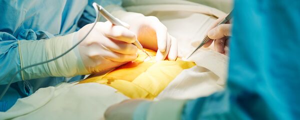 cấy ghép tim - Sputnik Việt Nam