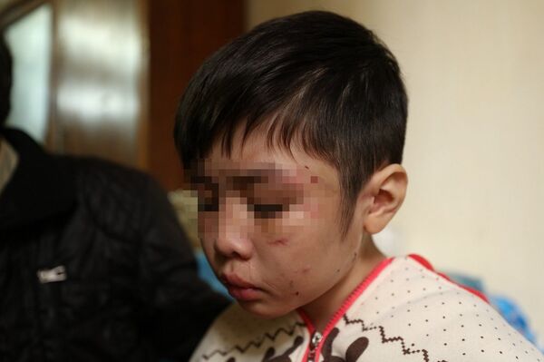 Bé trai 10 tuổi bị bạo hành - Sputnik Việt Nam