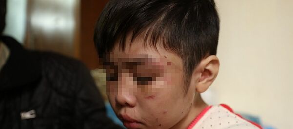 Bé trai 10 tuổi bị bạo hành - Sputnik Việt Nam