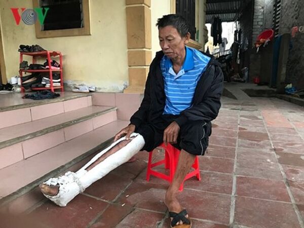 Ông Nguyễn Văn Năng người bị con trai đánh đập. Ông Nguyễn Văn Năng người bị con trai đánh đập. - Sputnik Việt Nam