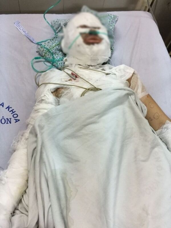 Chị H hiện đang được cấp cứu tại Bệnh viện Xanh Pôn. - Sputnik Việt Nam