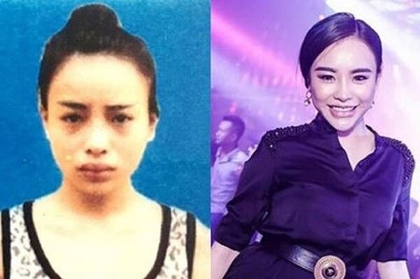 Hải Yến trước và sau phẫu thuật thẩm mỹ để trốn nã Hải Yến trước và sau phẫu thuật thẩm mỹ để trốn nã - Sputnik Việt Nam