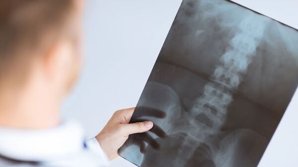 Bác sĩ kiểm tra phim chụp X-quang - Sputnik Việt Nam